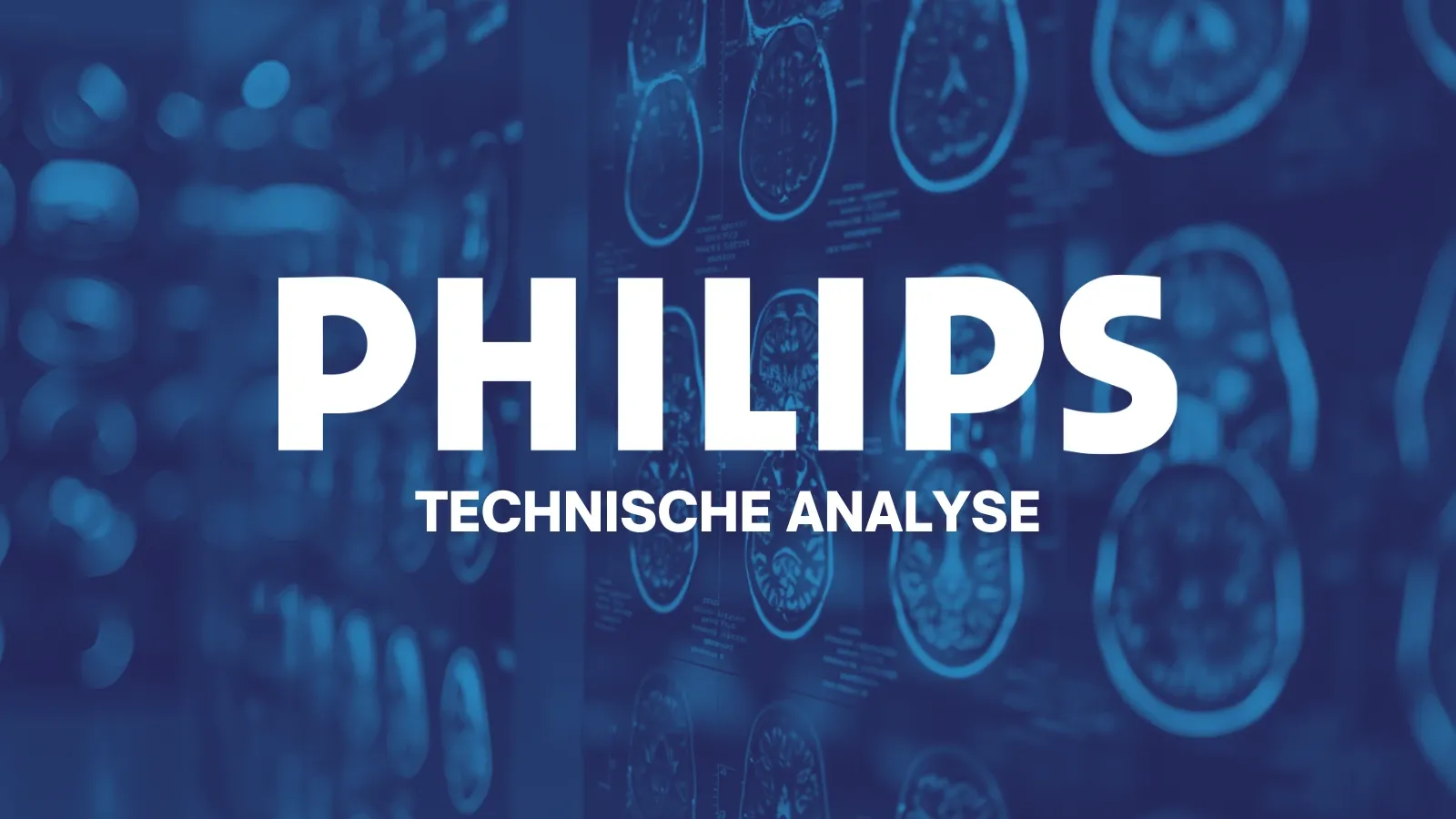 Philips: kan deze patiënt blijvend herstellen?